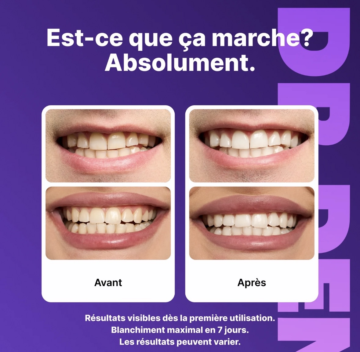 42 Bandes dent blanche