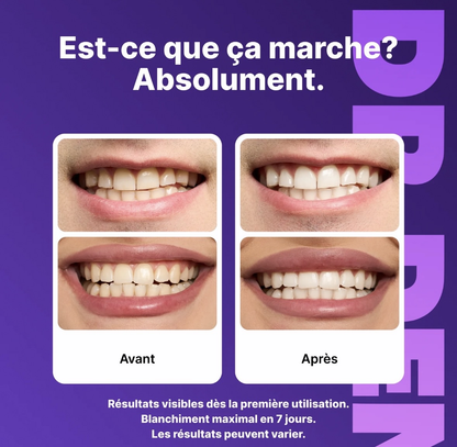 42 Bandes dent blanche